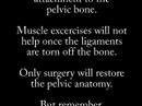 \"No Hysterectomy\" Advanced Female Pelvic Reconstruction \"No Hysterectomy\" Advanced Female Pelvic Reconstruction
