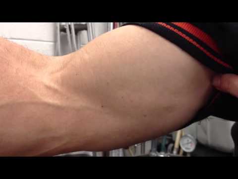 how to locate brachial pulse