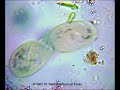 Paramecium Dividing