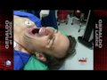 Dr. Alexander Sinclair provides you with a first hand look at the effects of Diprivan aka Propfol