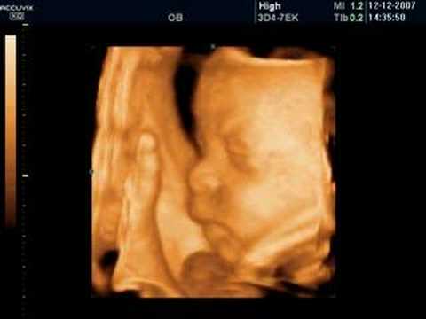 4d baby ultrasound scan pretecho 3d 4d