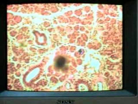 Salivary Glands & Pancreas Lab Part ...