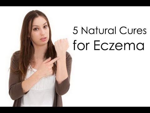 how to heal eczema naturally