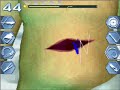 Trauma center under the knife 2 walkthrough operation 19