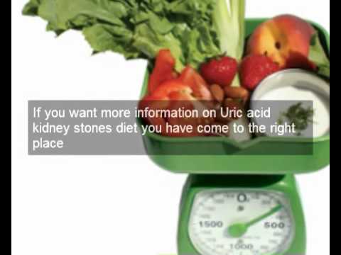 how to dissolve a uric acid kidney stone