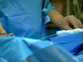 Uterine Fibroid Embolization