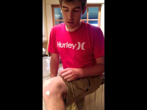 how to cure the sting of a bee