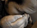 perfo en el tabique nasal perfo en el tabique nasal