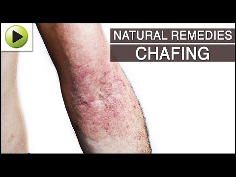 how to cure chafing