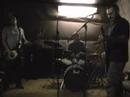 aneurysm