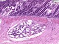Histología - Duodeno Histología - Duodeno