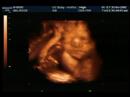 Presenting Melody Reigh Anne