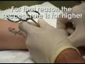 Női microdermal piercing  Surface Anchor Piercing - Wrist Piercing - Microdermal - Studio Nine - Essex
