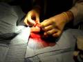 Keith - Cleaning before Stitches