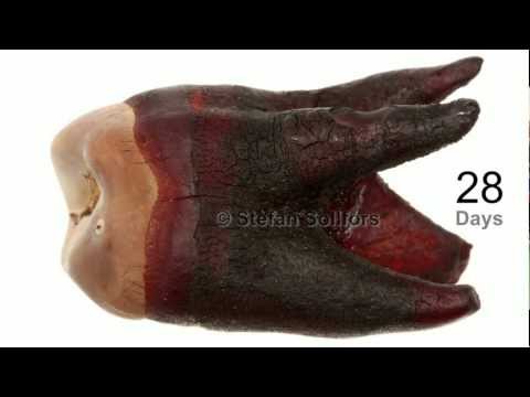 how to dissolve teeth