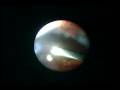 videos de Endoscopic view of Alcon 23G 3G