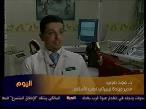 تفريش