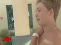 shark bites teen in florida