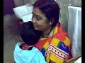 A child with cerebral palsy in HRB Clinic