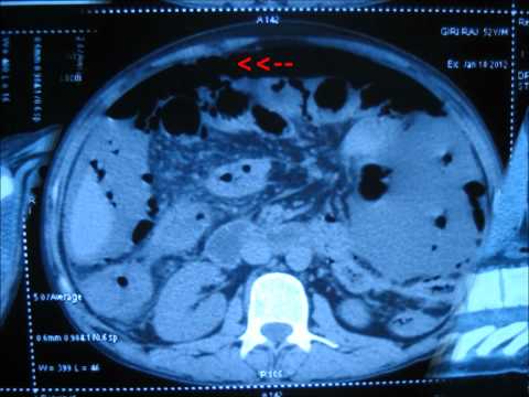how to repair ct scan machine
