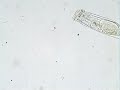 Rotifer, Filinia opoliensis.wmv