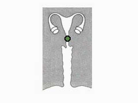 how to dissolve sperm