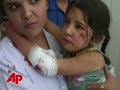 deadliest blast in years rocks afghan capital