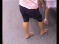 polio polio