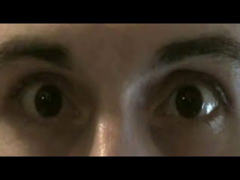 how to locate blind spot in eye