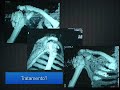 Discuss�o de casos de ombro e cotovelo