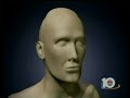 WPLG - Miami Local 10 - Brain Surgery