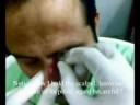Revolution of Treatment : Cupping therapy \"Higama\" Revolution of Treatment : Cupping therapy \"Higama\"
