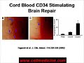 Stem Cell Therapy for Cerebral Palsy