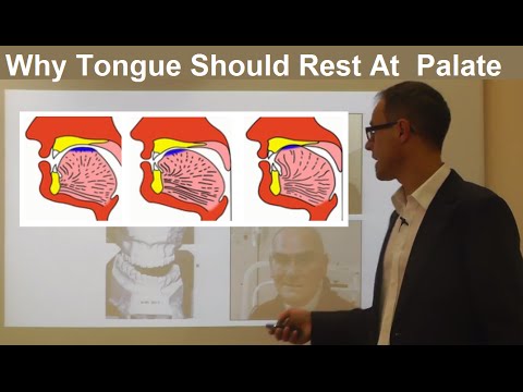 Should Tongue Rest/ Touch at the Palate/ Maxilla/ Roof of the Mouth By Dr Mike Mew