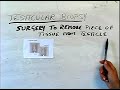 How to Perform a Testicular Cancer Exam : What is a Testicular Biopsy?