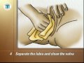 PostCare Recovery: Female Self Catheterization