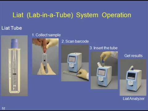 how to treat cmv virus
