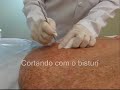 Cirurgia