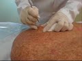 Cirurgia Cirurgia