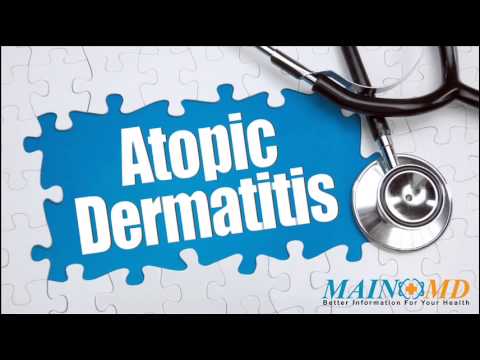 how to treat atopic dermatitis