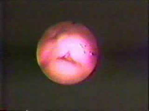 Mel Blanc's Vocal Cords