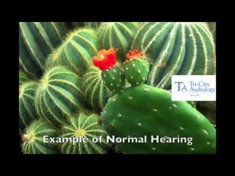 What does hearing loss sound like?