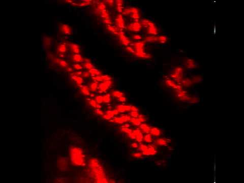 Spirogyra – unhealthy chloroplast (Thu AM 308 group 1 Leica)