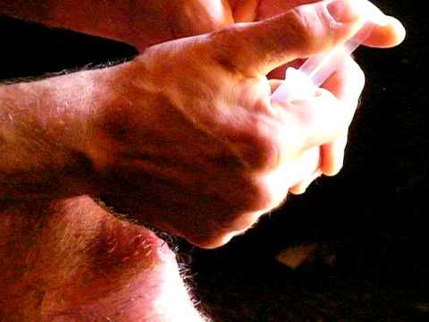 No insrance so DIY sugery act1