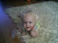 achondroplasia