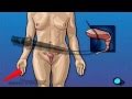 Women's Center Cystoscopy Female Vaginal PreOp® Patient Education