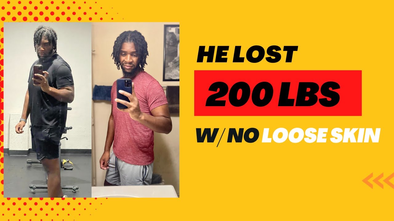 Lost Nearly 200 lbs With No Loose Skin Reversed Depression and Transformed His Life (PART 1)