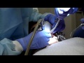 Cavities