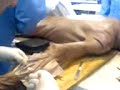diseccion antebrazo posterior