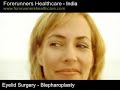 Eyelid rejuvenation surgery in India for restoring a more youthful and energetic look.